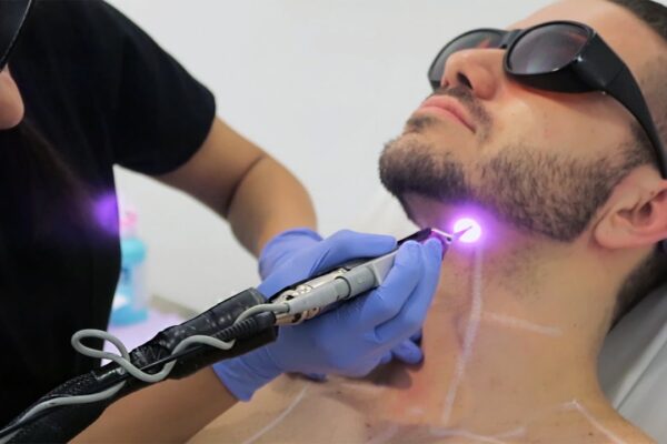 Laser Hair Removal treatment for smooth and hair-free skin