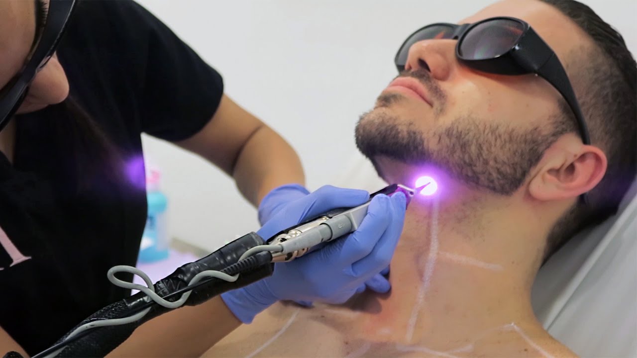 Laser Hair Removal treatment for smooth and hair-free skin