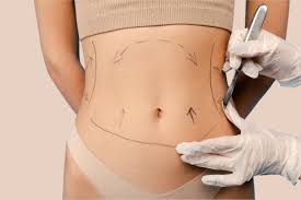 vaser liposuction in dubai
