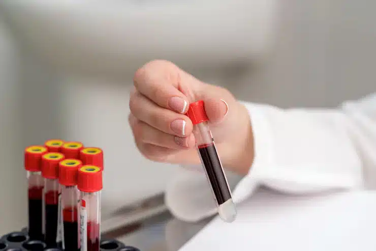 What Is a Private Blood Test and How Is It Different from NHS Testing?