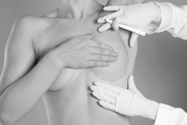 Breast Reduction in Dubai