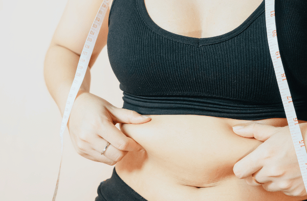 liposuction in dubai