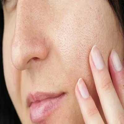 How Large Pores Treatment in Riyadh Helps Improve Skin Texture