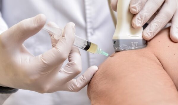 Prp treatment Michigan