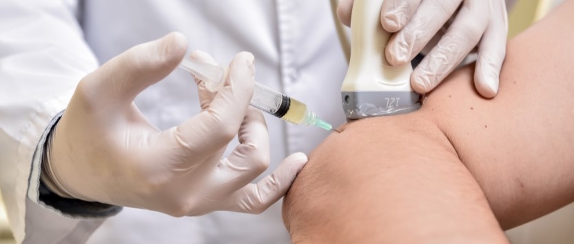 Prp treatment Michigan