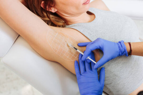 Can Botox Treat Excessive Sweating Issues