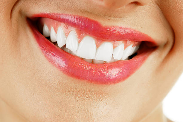 Does E-Max Veneers Require Multiple Dental Visits