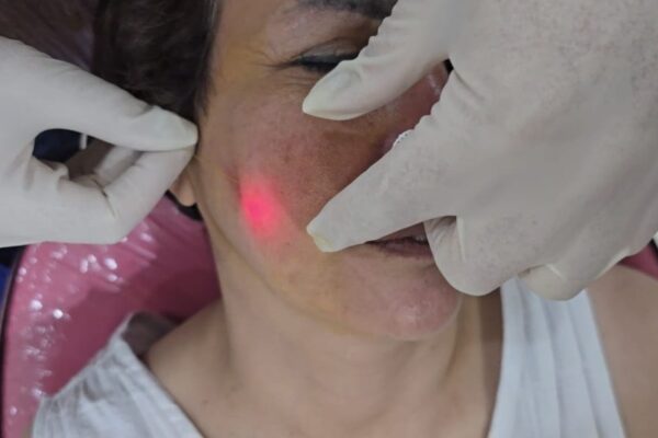 EndoLift in Abu Dhabi