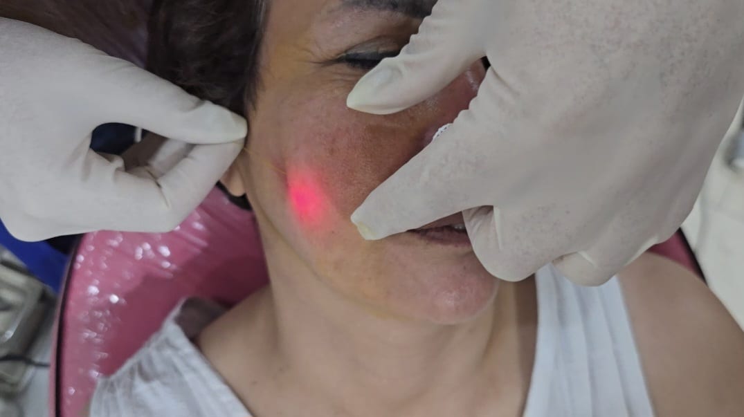 EndoLift in Abu Dhabi