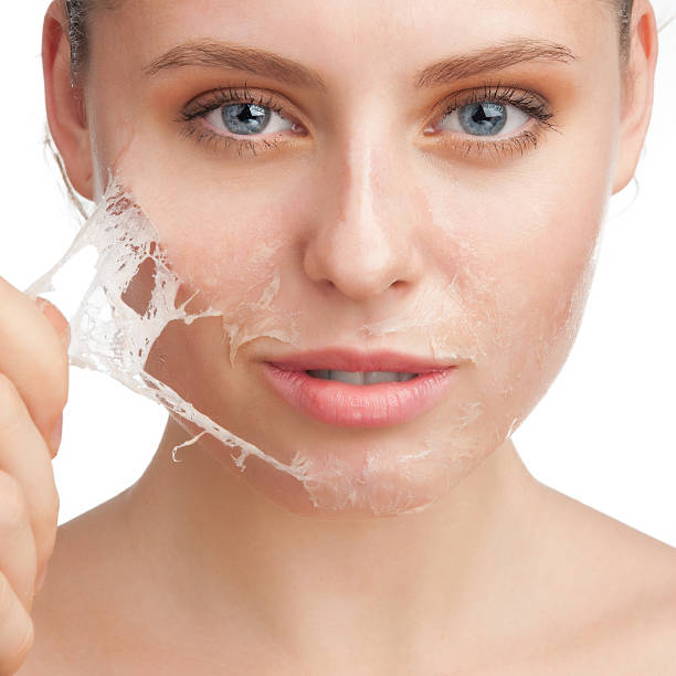 How Can Chemical Peel Boost Your Skin's Natural Glow