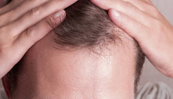 How G Cell Treatment Helps Skin Look Fresher