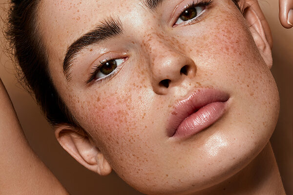How Many Sessions for Melasma Treatment