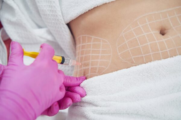 How Safe Are Modern Fat Melting Injections?