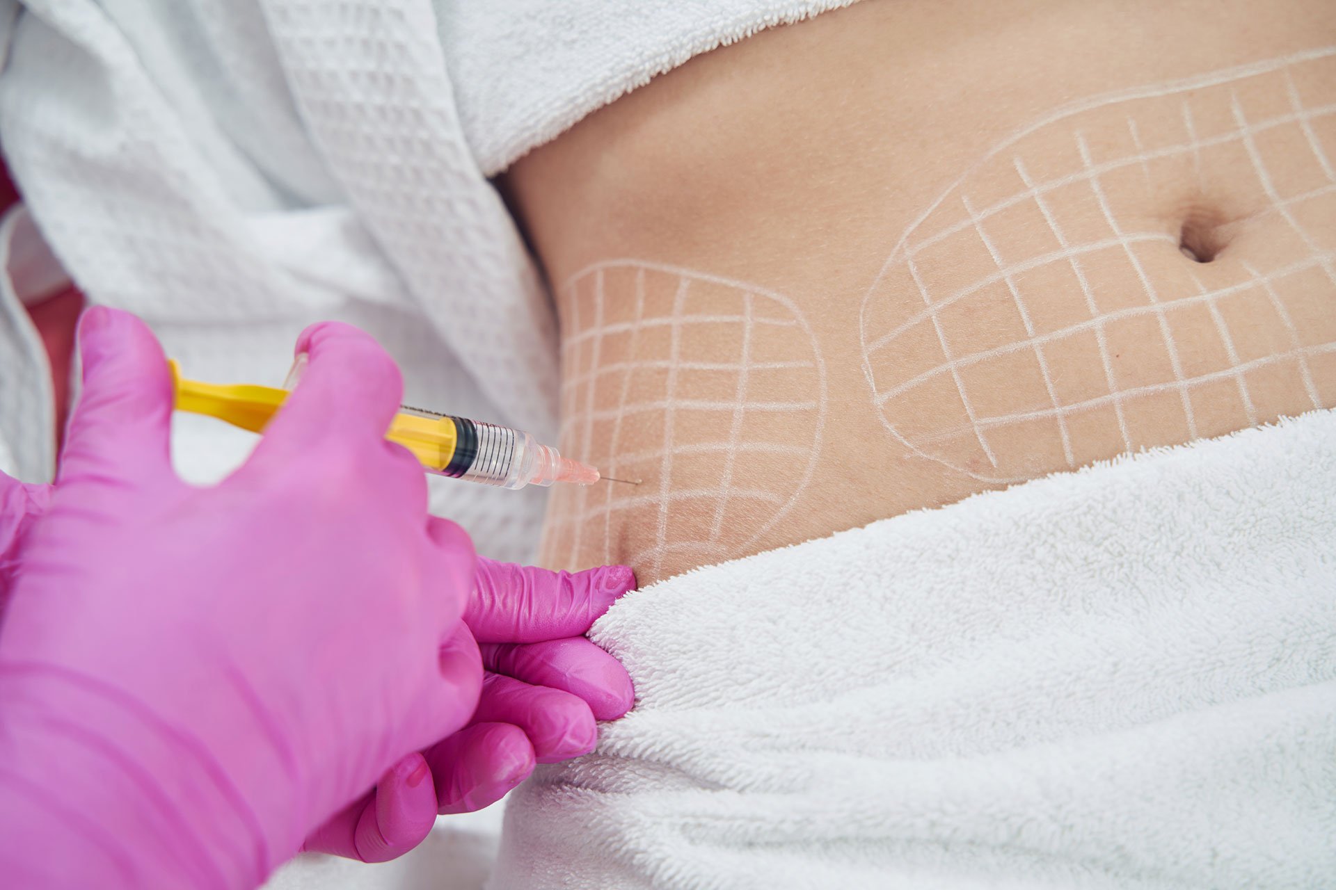 How Safe Are Modern Fat Melting Injections?