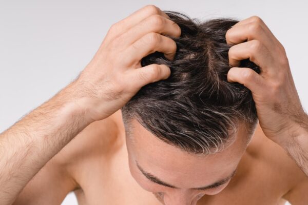How Safe Is Modern Hair Loss Treatment Today?