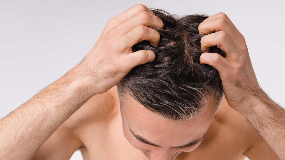 How Safe Is Modern Hair Loss Treatment Today?