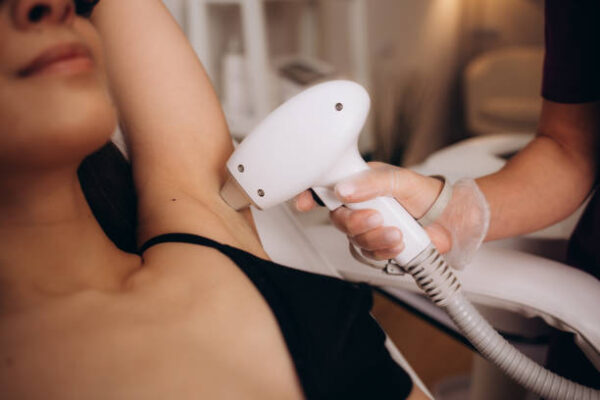 Is Laser Hair Removal a permanent hair solution