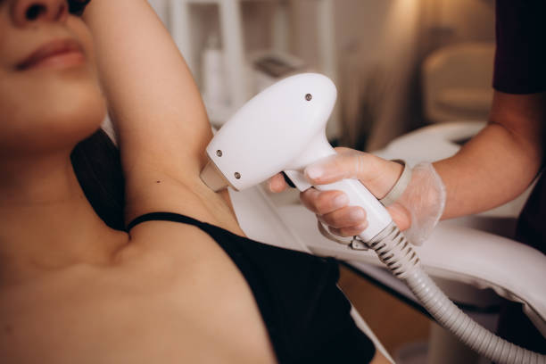 Is Laser Hair Removal a permanent hair solution