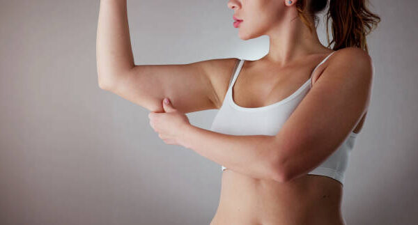 Is Liposuction Effective for Arm Fat Reduction