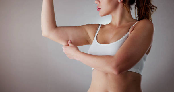 Is Liposuction Effective for Arm Fat Reduction