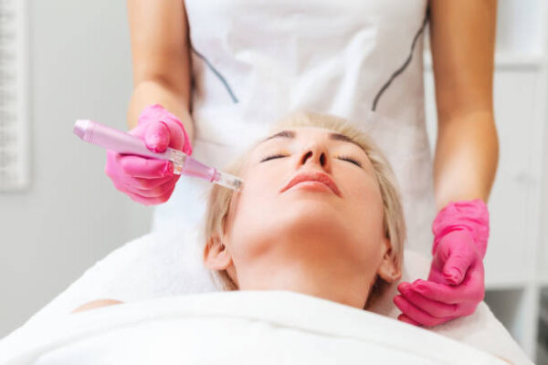 Is Microneedling Effective for Wrinkle Reduction