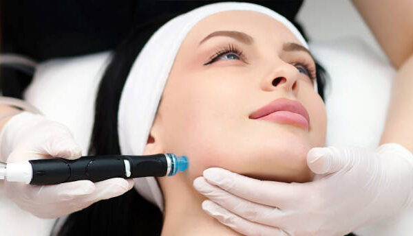 Is Microneedling a Permanent Skin Solution