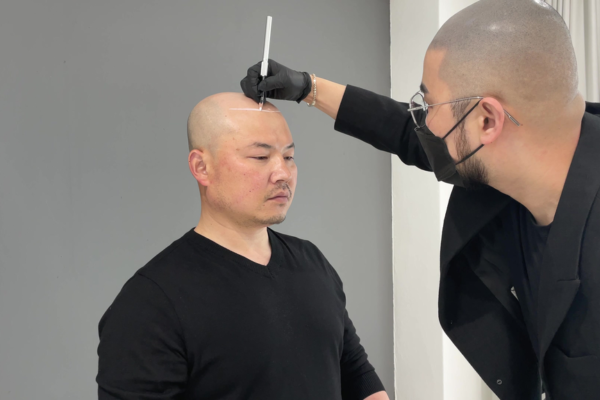 Scalp Micropigmentation in Abu Dhabi