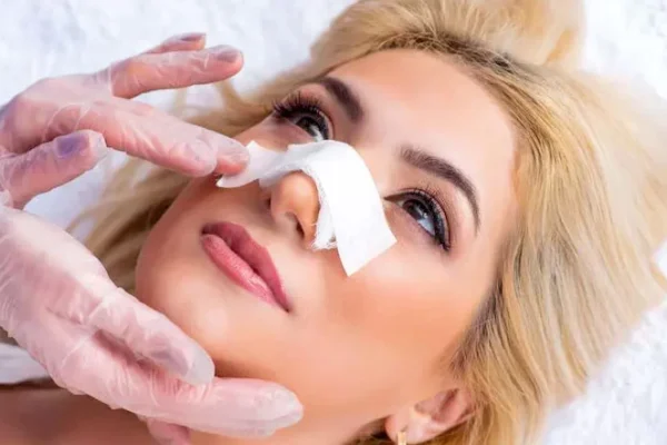 Subtle Changes Stunning Results Rhinoplasty