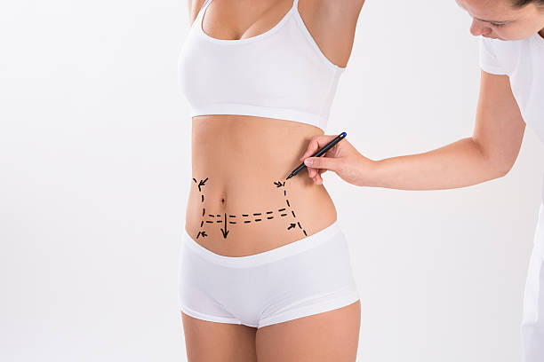 What Are Alternatives to a Full Tummy Tuck Surgery