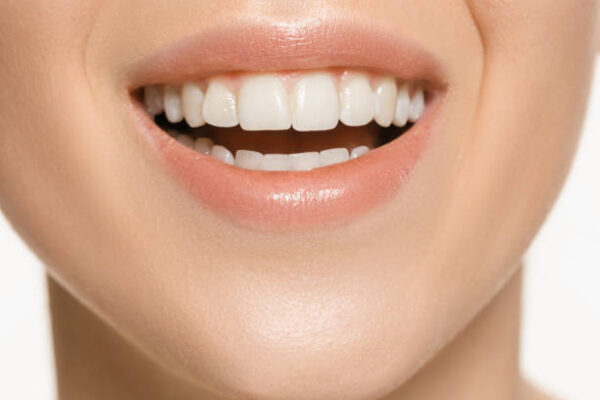 What Are Teeth Whitening Tips for Longer-Lasting Brightness