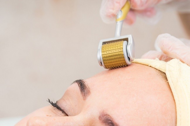 What Areas Can Derma Roller Treatment Treat?