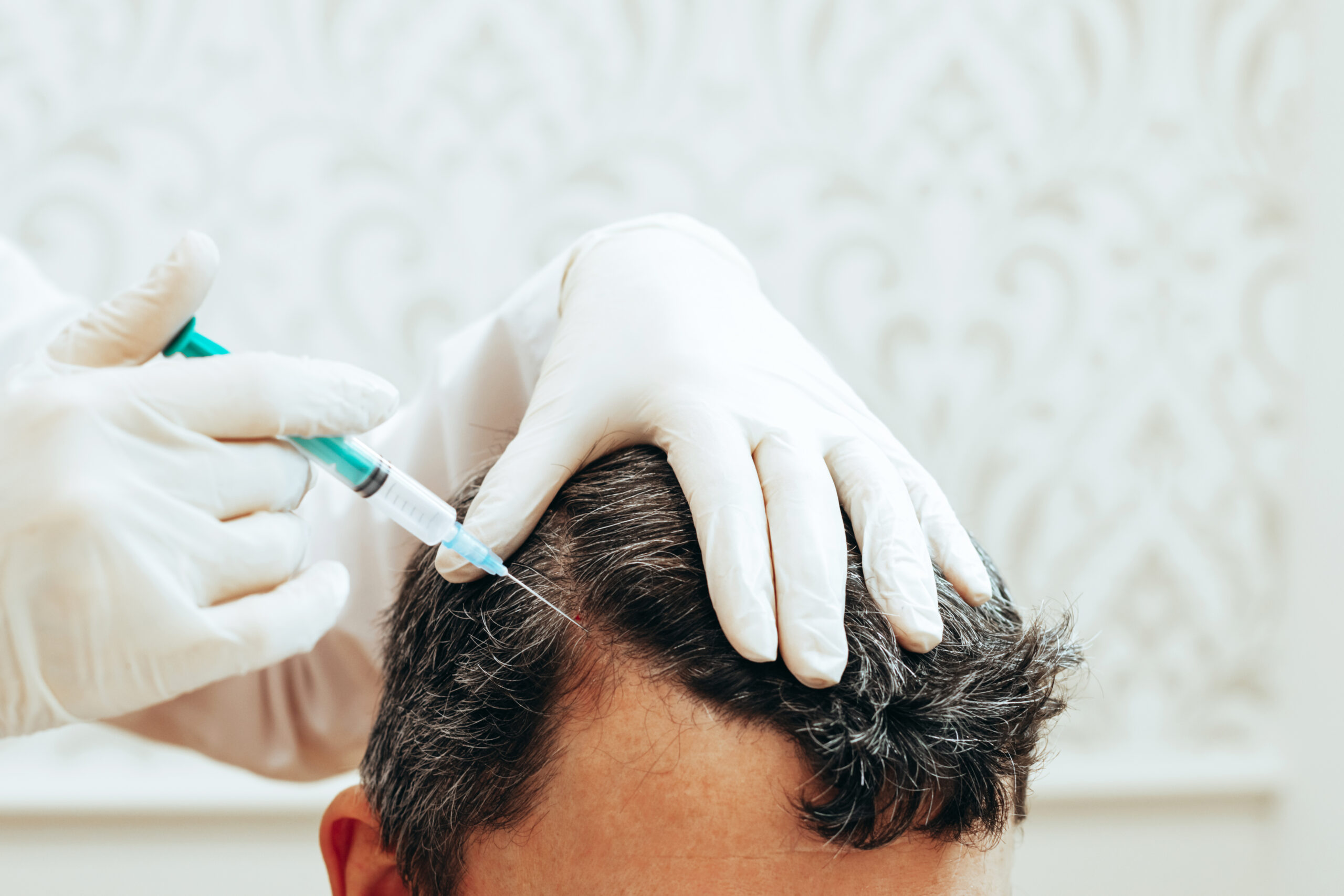 Best PRP Hair Treatment in Abu Dhabi