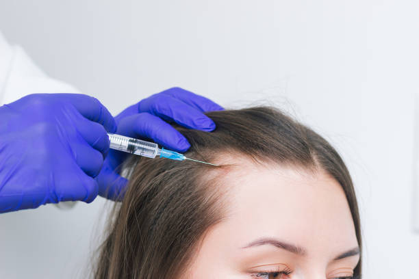 What PRP treatment Can Do for Hair Fall and Regrowth Support