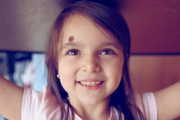 علاج الورم الوعائي الدموي في أبوظبي