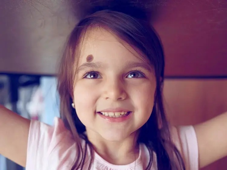 علاج الورم الوعائي الدموي في أبوظبي