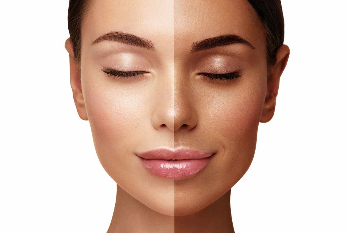 لاج إزالة السمرة في أبوظبي