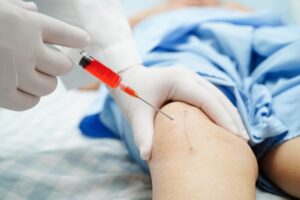 حقن الركبة PRP في أبوظبي