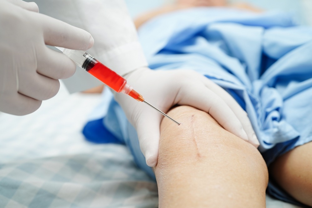 حقن الركبة PRP في أبوظبي