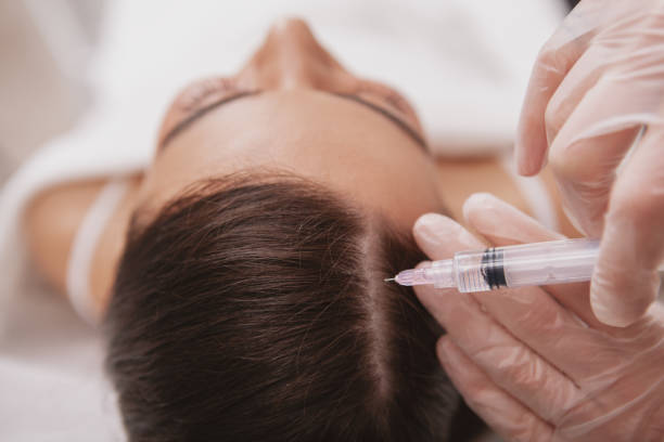 Can Best PRP Hair Treatment Fix Bald Spots