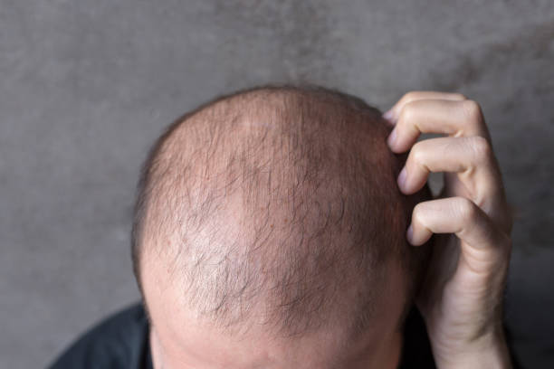 Can GFC Treatment for Hair Improve Hair Texture Fast