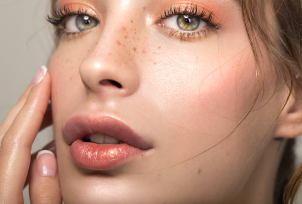 Can Melasma Treatment Remove Dark Patches Fast