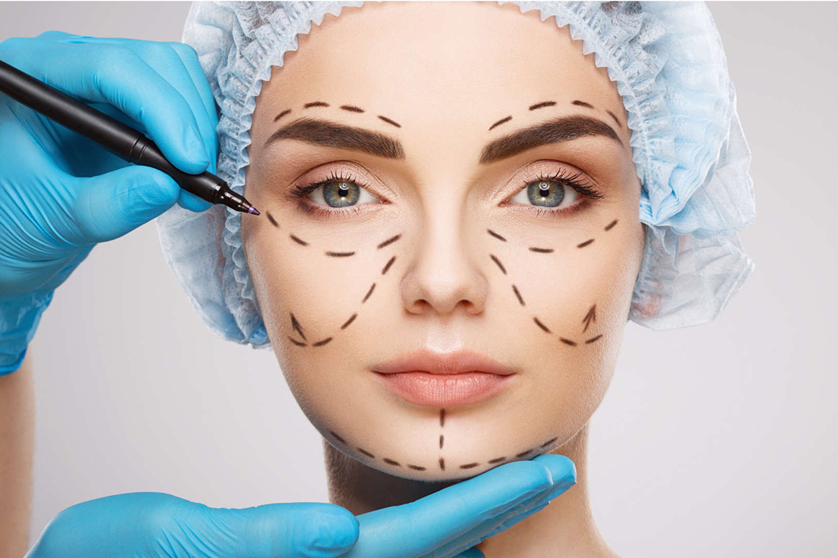 Do Facelifts Help Restore Facial Definition Fast