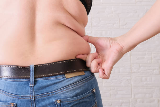 Do Fat Reduction Treatments Require Recovery Downtime