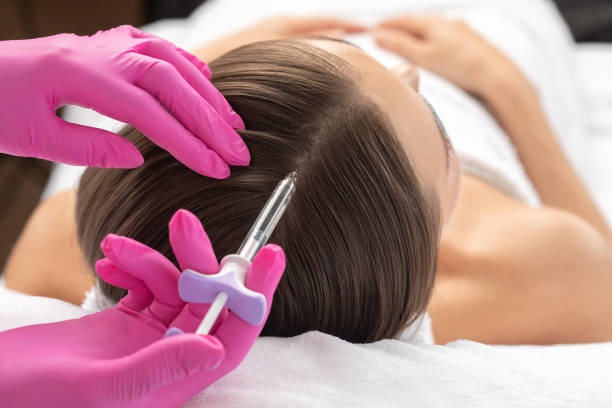 Does Best PRP Hair Treatment Improve Hair Density Fast