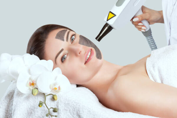 Does Laser Carbon Peel Brighten Dull Skin