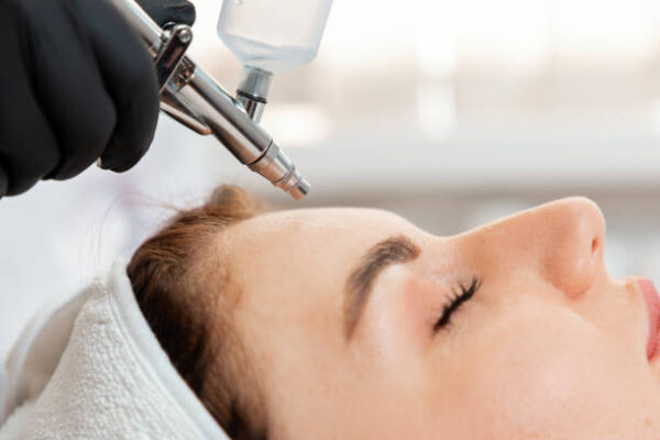 Does Oxygen Facial Help Acne-Prone Skin
