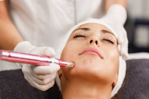 Does RF Microneedling Help Reduce Large Pores