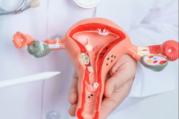 Premature Ovarian Failure Treatment In Dubai