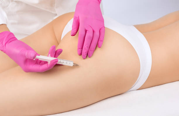 How Do Butt Fillers Create Fuller Curves Without Surgery