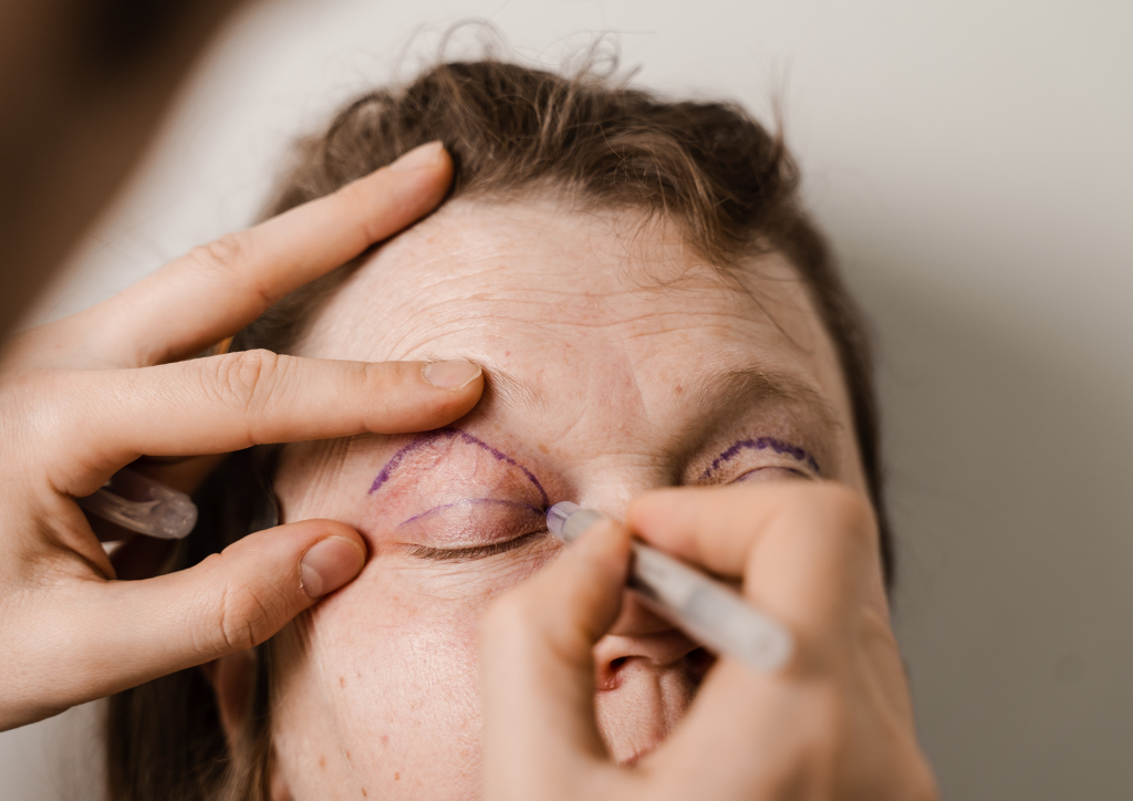 Eyelid Surgery in Abu Dhabi